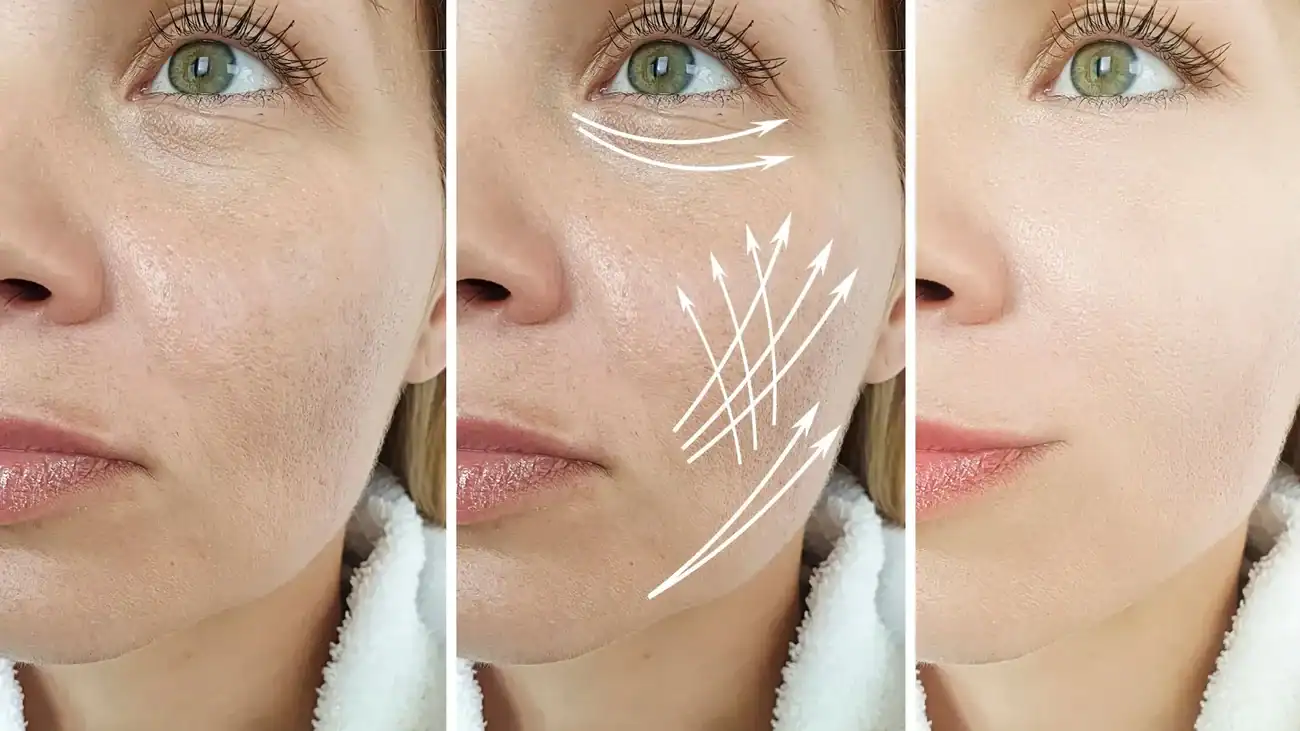 Can One Treatment Really Tackle More Than One Skin Concern Walton on the Hill?