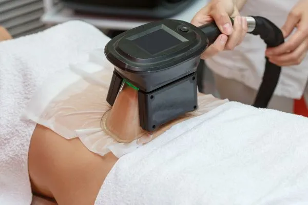 Image of person having fat freezing treatment to help weight gain Walton on the Hill