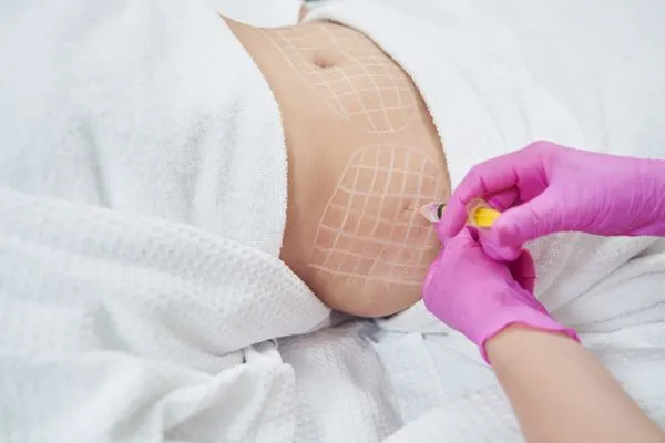 image of fat dissolving injections on love handles to help combat weight gain Walton on the Hill