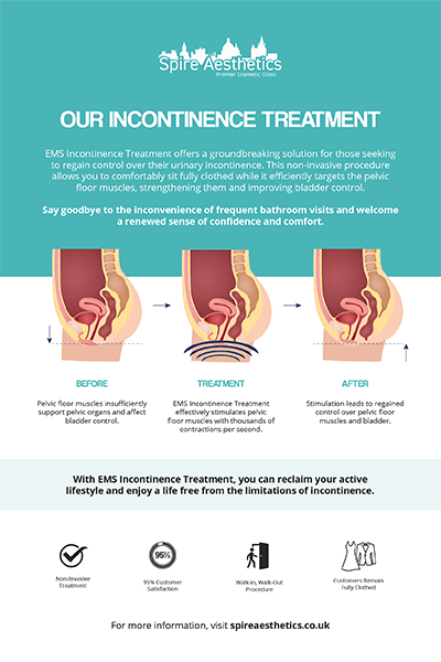 image of how urge incontinence Walton on the Hill treatment works