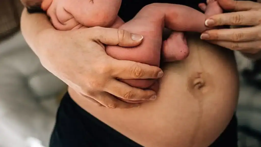 Why Is My Stomach Still Big After Pregnancy Walton on the Hill?